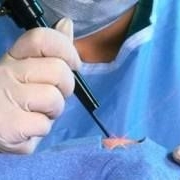 С какой целью используют медицинские лазеры