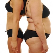 Радиочастотная липосакция Body Tite