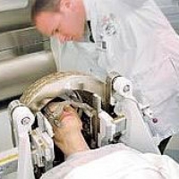 Гамма-Нож (Gamma Knife®): принцип действия, преимущества и недостатки